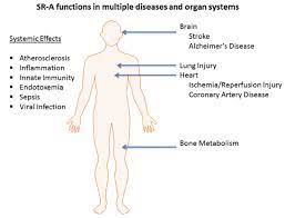 HWEL2001 Body Systems And Disease Assignment Part B-Laureate International University Australia. 3 HWEL2001 Body Systems And Disease Assignment Part B-Laureate International University Australia.